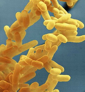 Escherichia coli